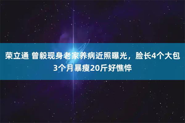 荣立通 曾毅现身老家养病近照曝光，脸长4个大包3个月暴瘦20斤好憔悴